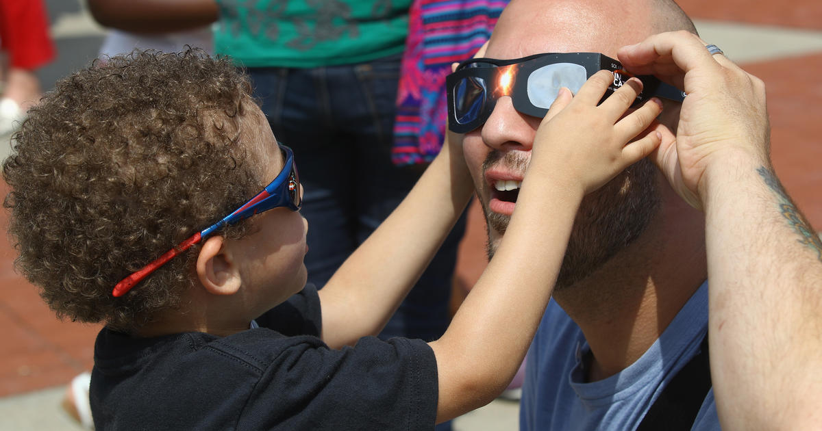 Why do you need special glasses to watch a solar eclipse? Doctors