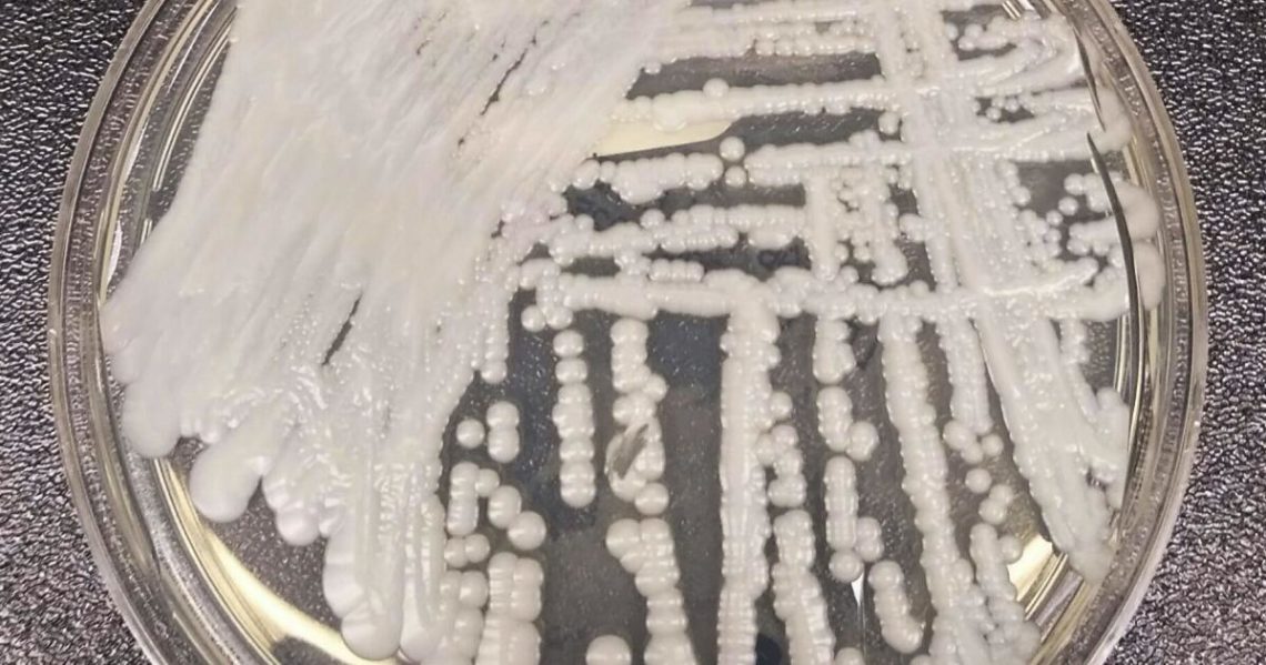 Drug Resistant Fungus Spreading Quickly In European Hospitals - w2idery
