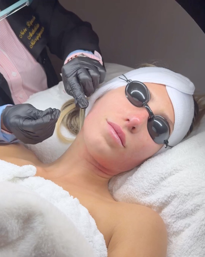Alix Earle promoting a skin service. 