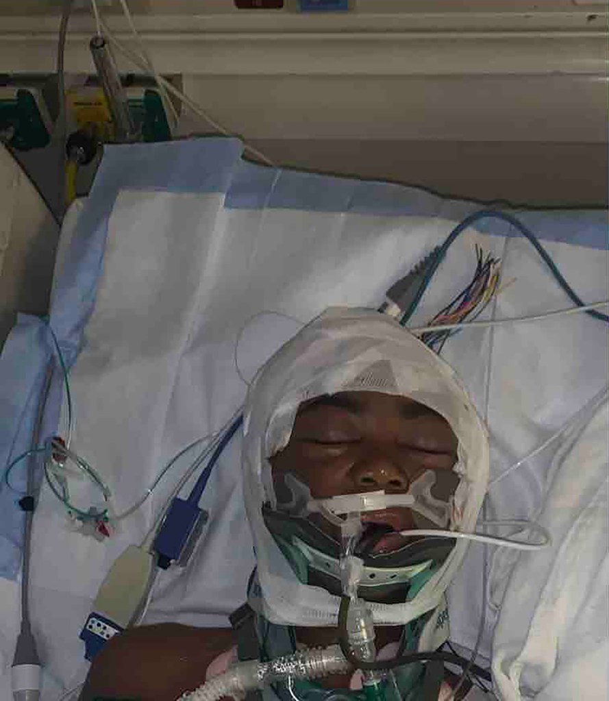 Florida schoolboy Louis Johnson in hospital
