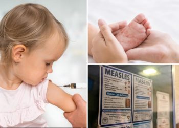 Measles infections top 800 cases across 24 states