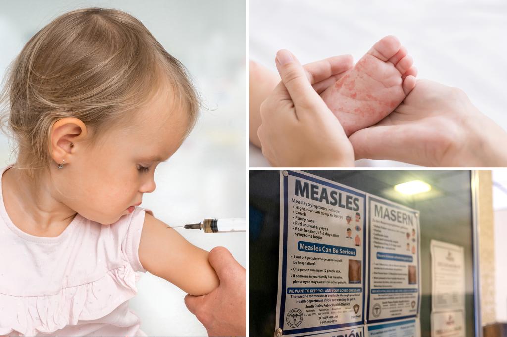 Measles infections top 800 cases across 24 states