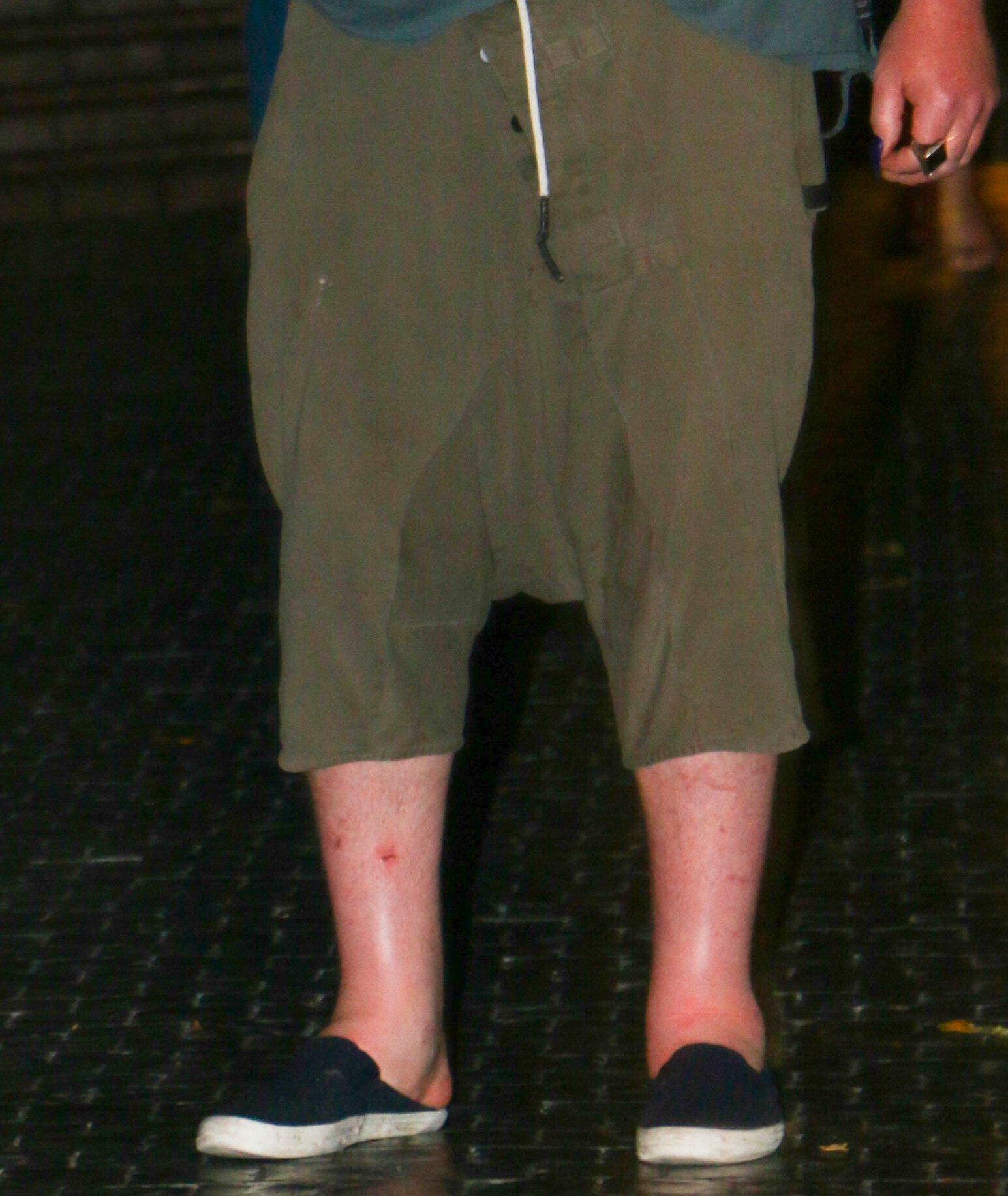 Elijah Blue Allman's knee shorts. 