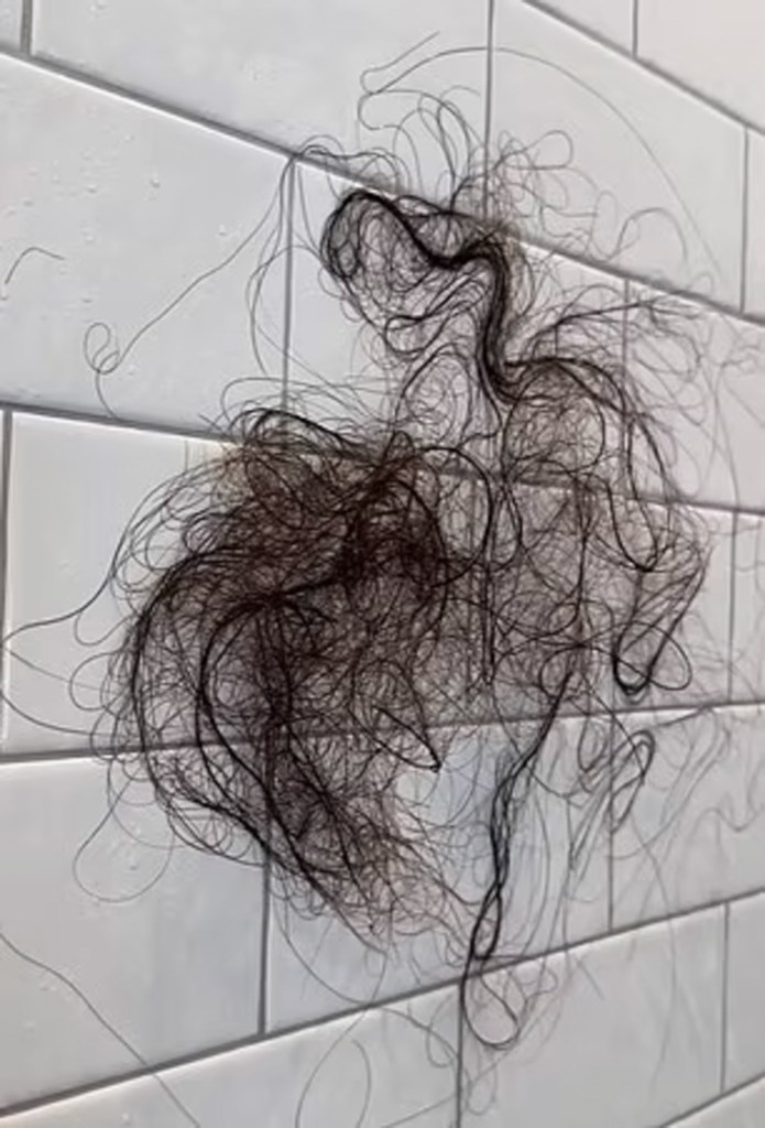 Kyle Richards' daughter Sophia shocks fans with dramatic hair loss 