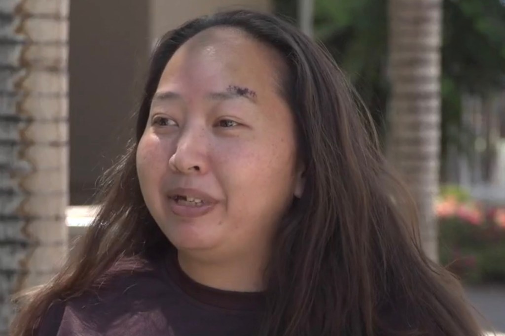 Diane Ung speaks out after the suspected assault on her and her daughter in front of their home.