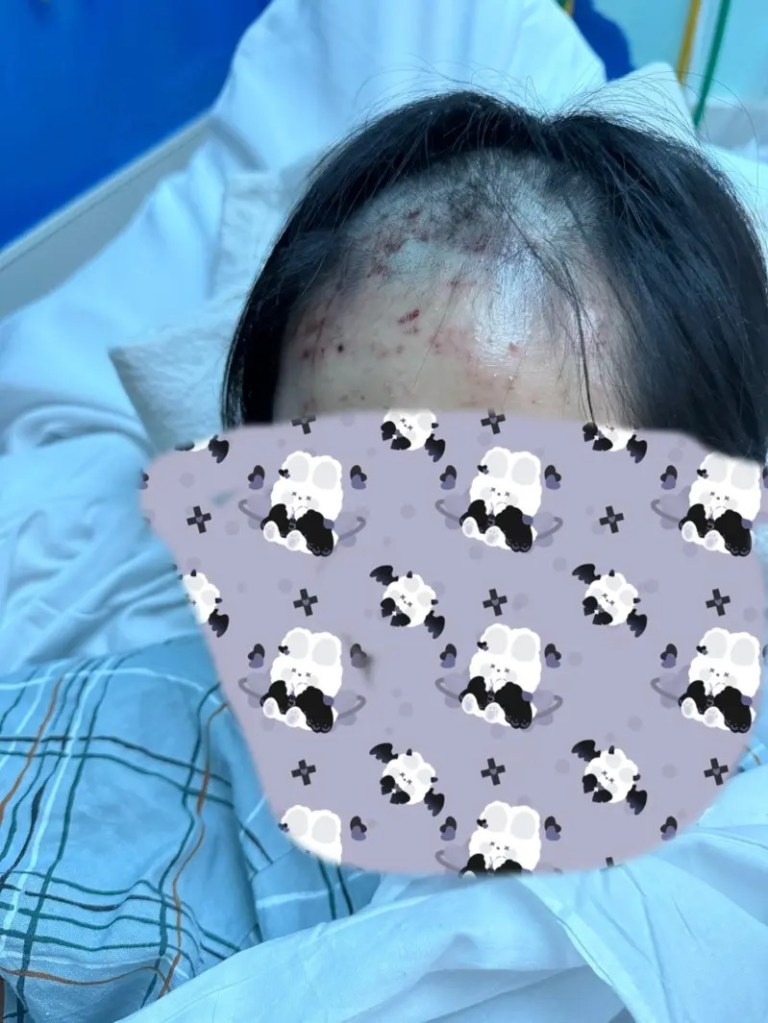 Photo of teen girl in hospital bed, part of head shaved, face blurred