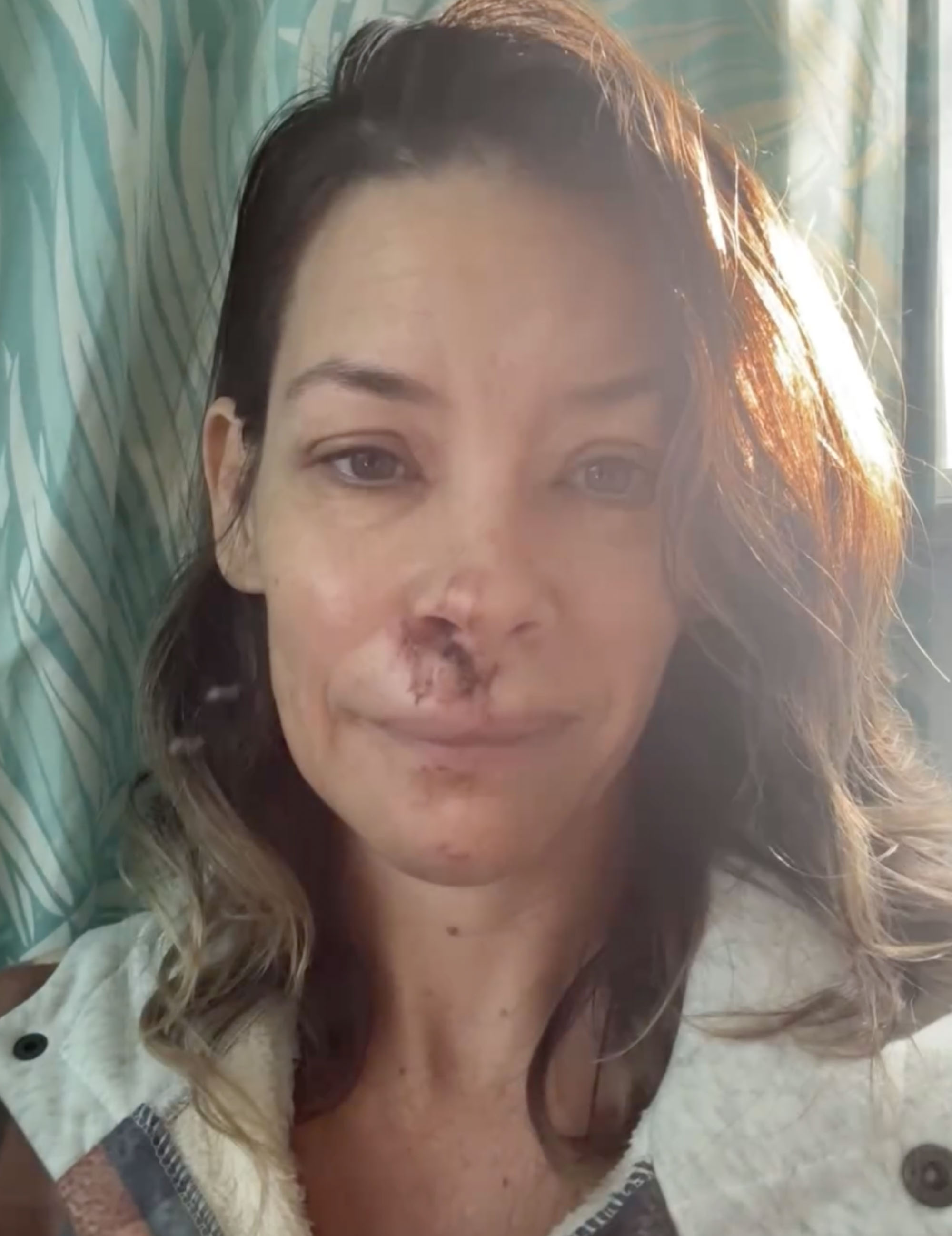 Evangeline Lilly with a bloodied and bruised face