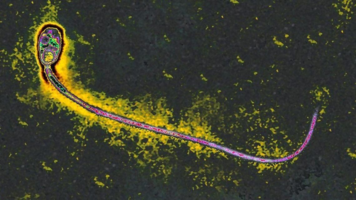 Crazy ‘cat lady’ parasite decapitates sperm, ‘colonizes’ testes