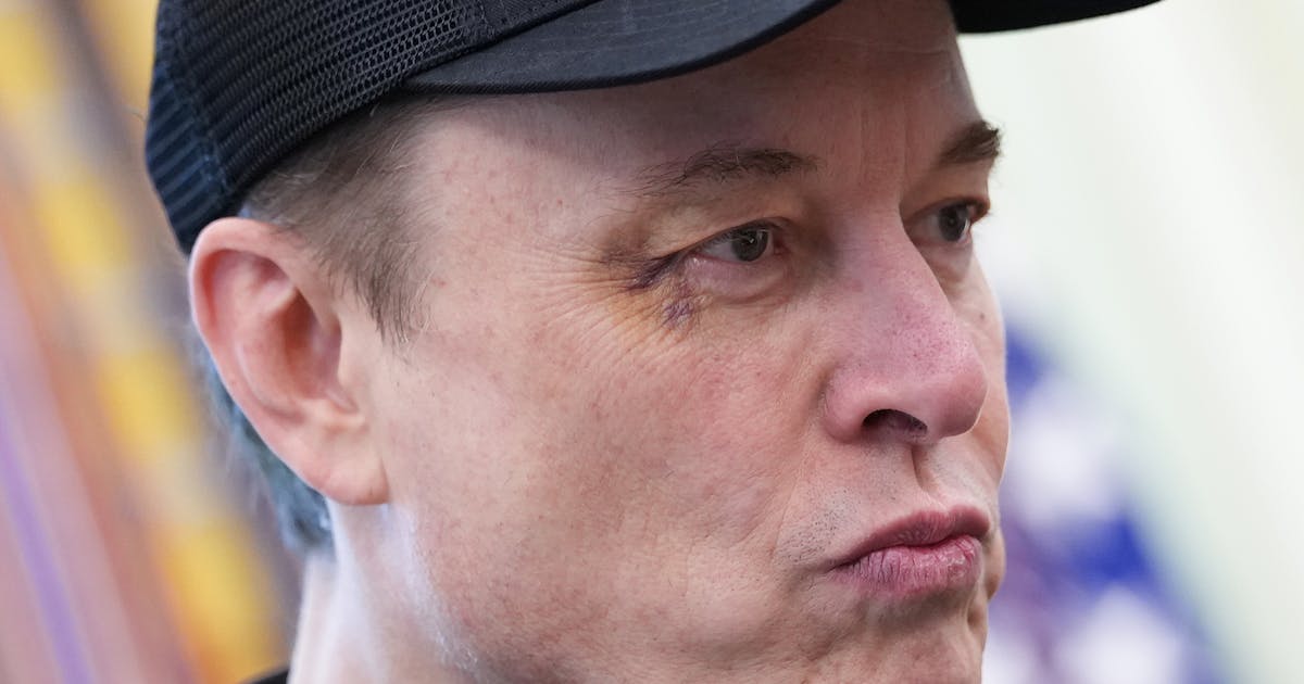 Elon Musk Gives Strange Excuse for Massive Black Eye – DNyuz