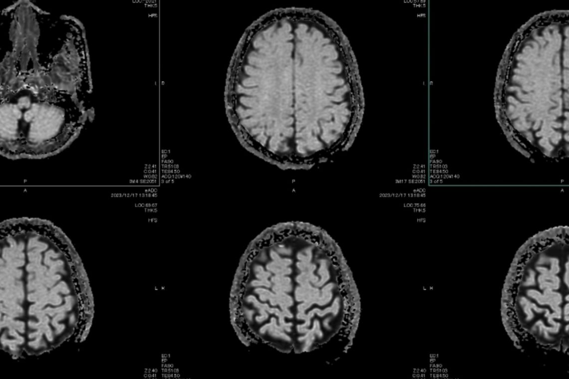 This Is What Working Too Much Does to Your Brain