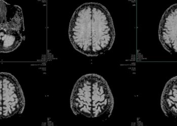 This Is What Working Too Much Does to Your Brain