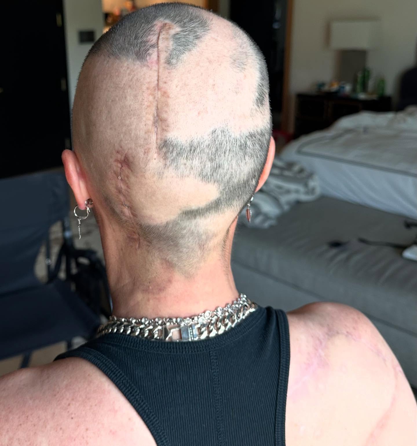 Teddi Mellencamp's shaved head