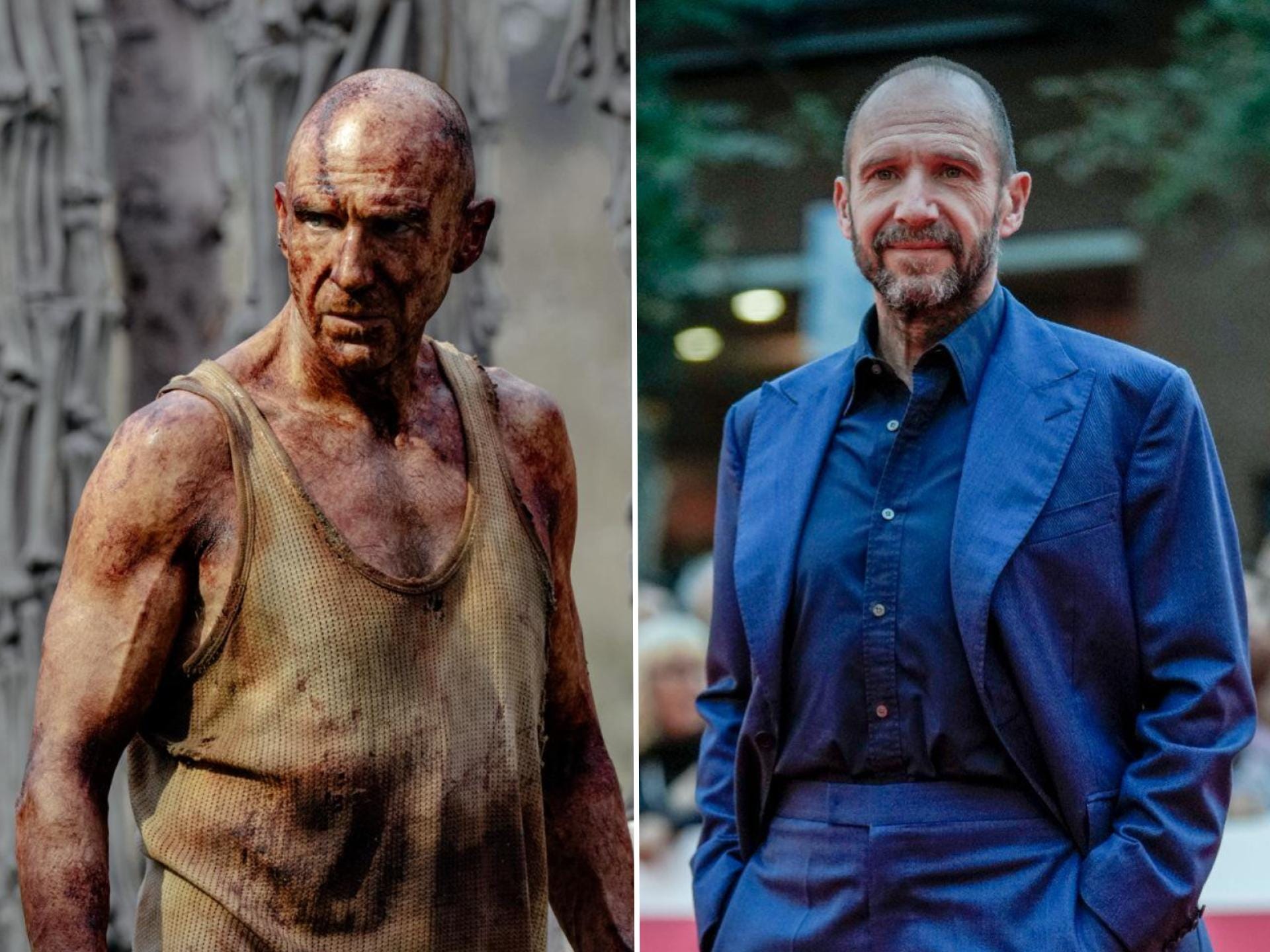 A split image of the same man. On the left, he's bald and covered in dried blood and bruises. H's wearing a dirty white vest that is stained yellow, red, and black. There are lots of leg bones strung up into poles behind him. On the right, he has short brown and gray hair and a beard. He's wearing an all blue suit with his hands in his pockets.