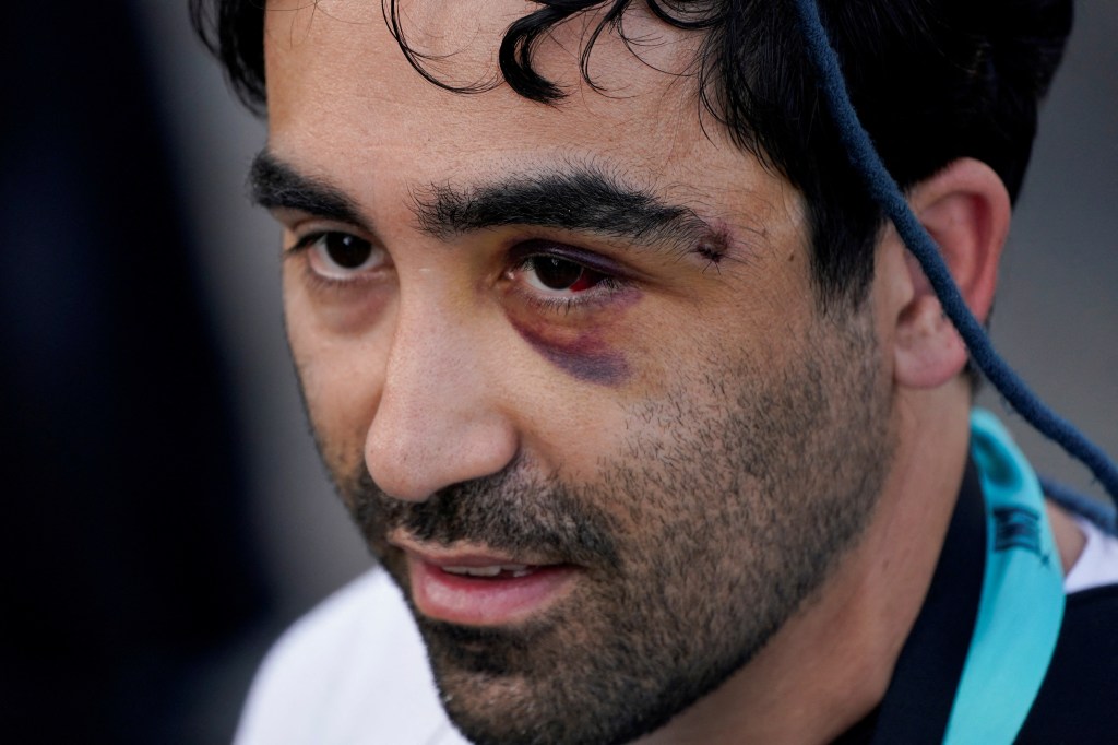 Injured journalist at a Los Angeles protest.