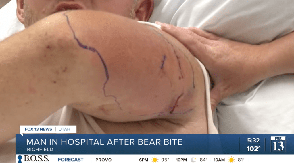 Screenshot of a man's injured arm with markings, headline reads 