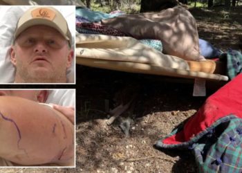 Utah construction worker fights off ‘crazy’ black bear during campsite attack: report