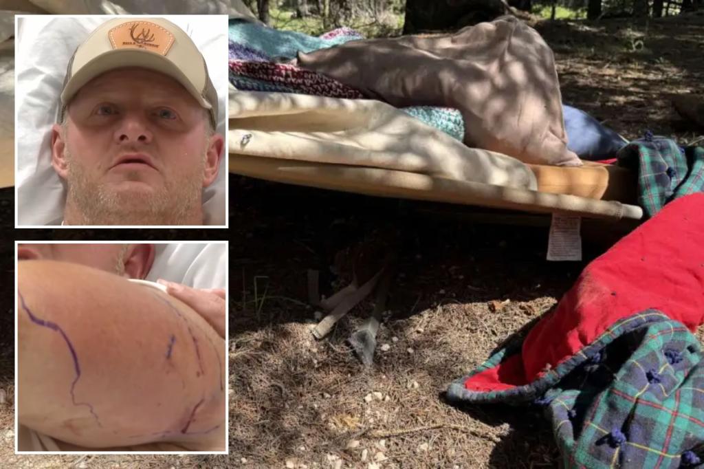 Utah construction worker fights off ‘crazy’ black bear during campsite attack: report