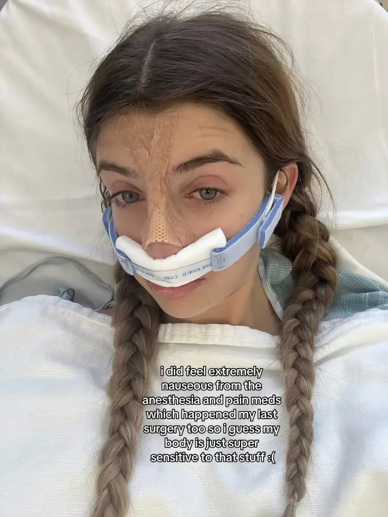 Sami Sheen after her nose job