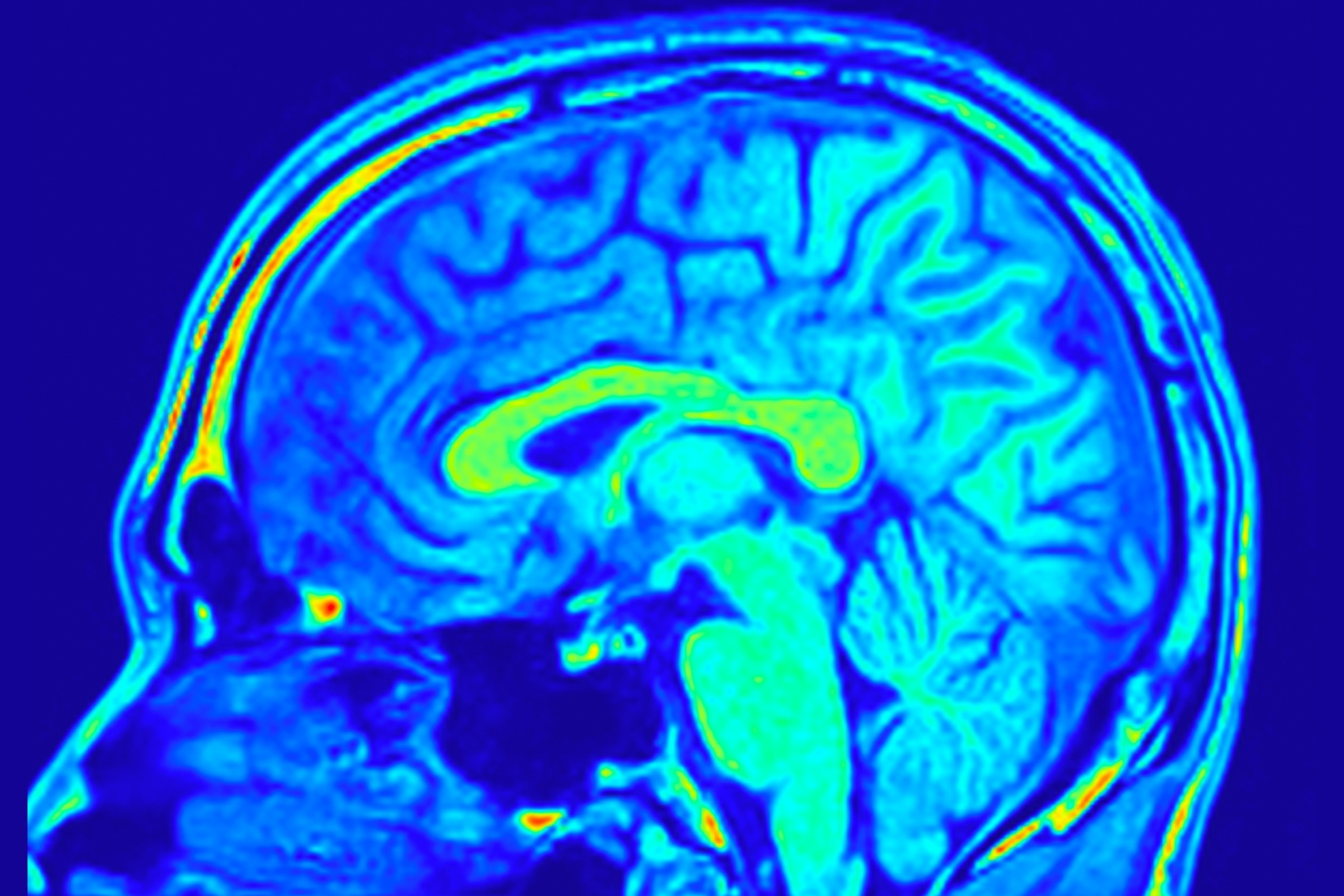 brain glowing under MRI