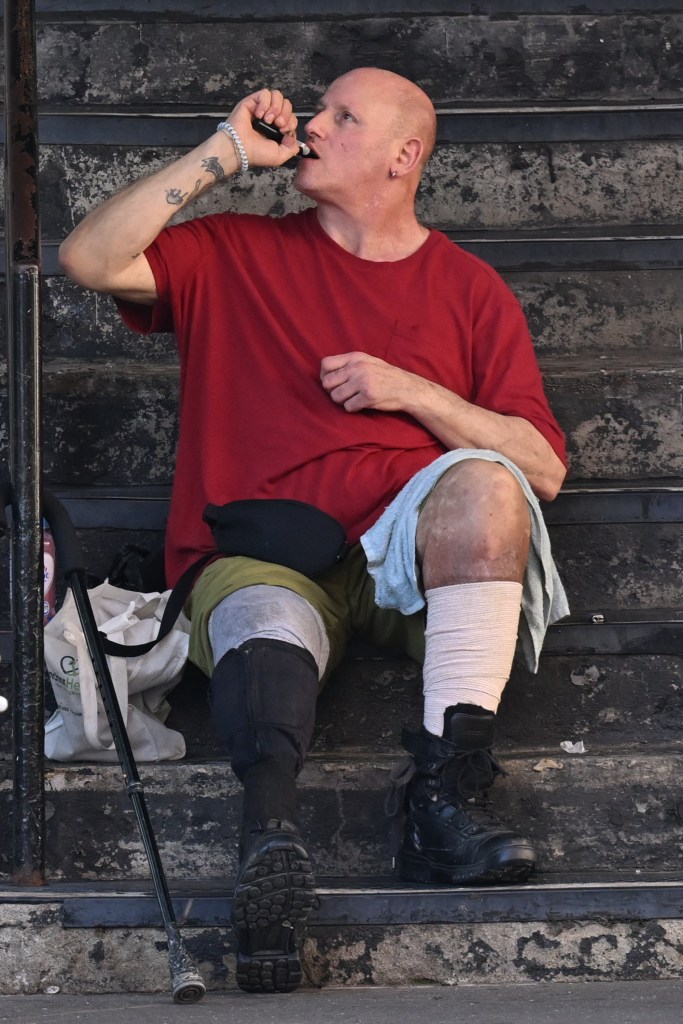 Man with leg injury sits on steps vaping.
