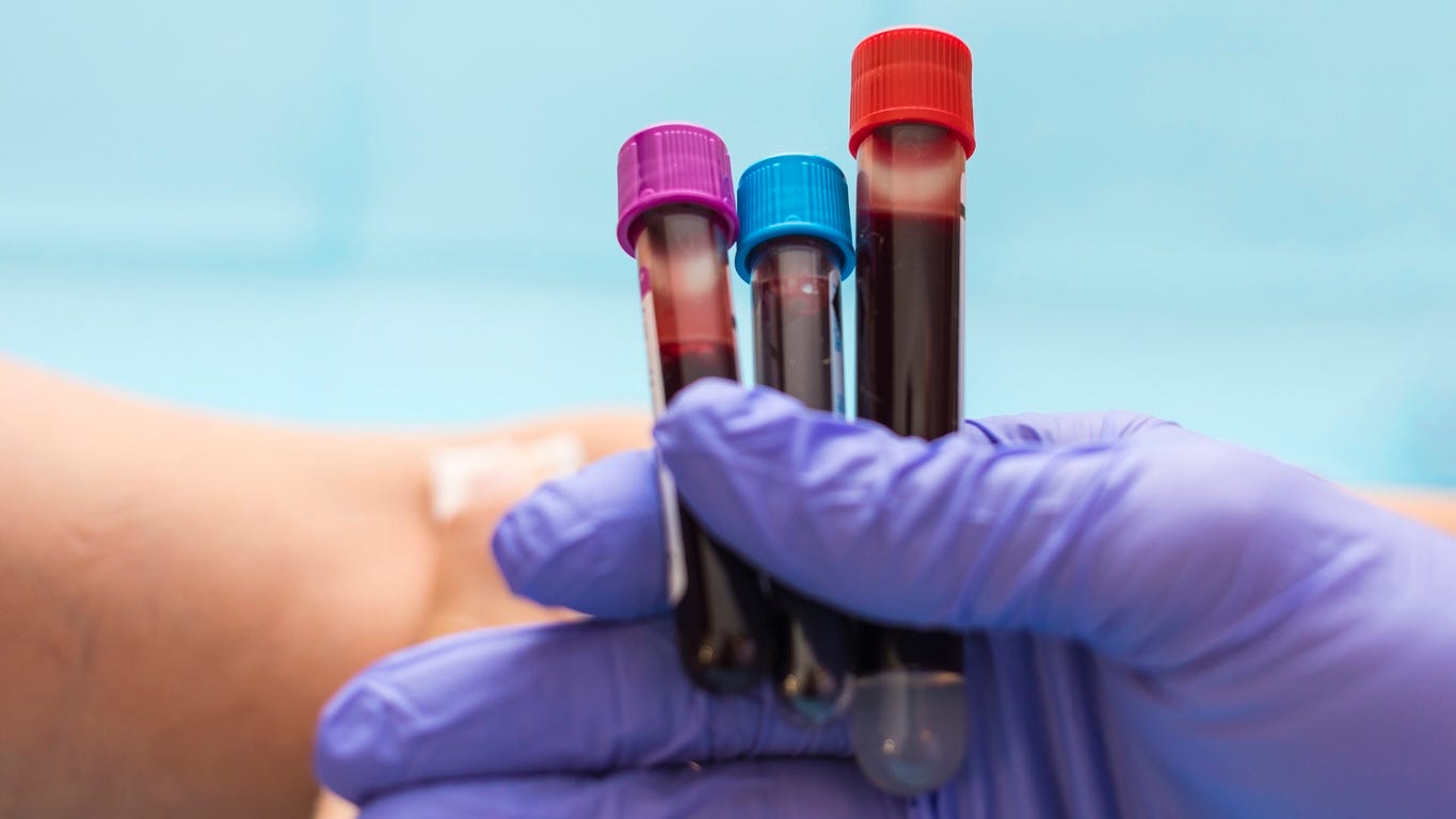 blood test tubes filled with blood