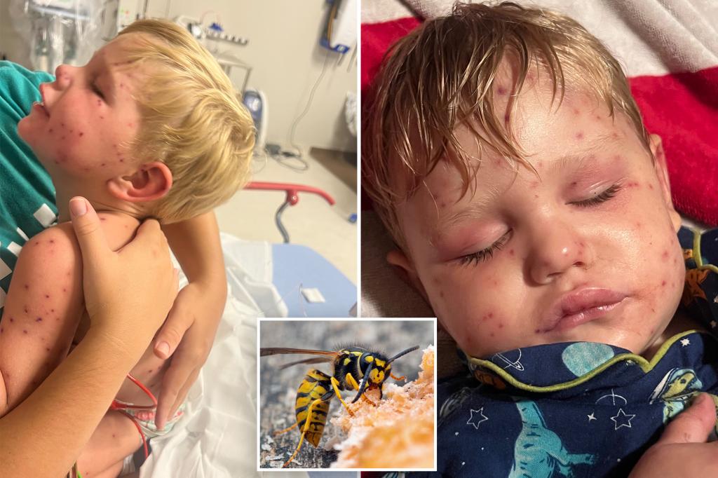 Georgia toddler fighting for life after being stung over 150 times by wasps