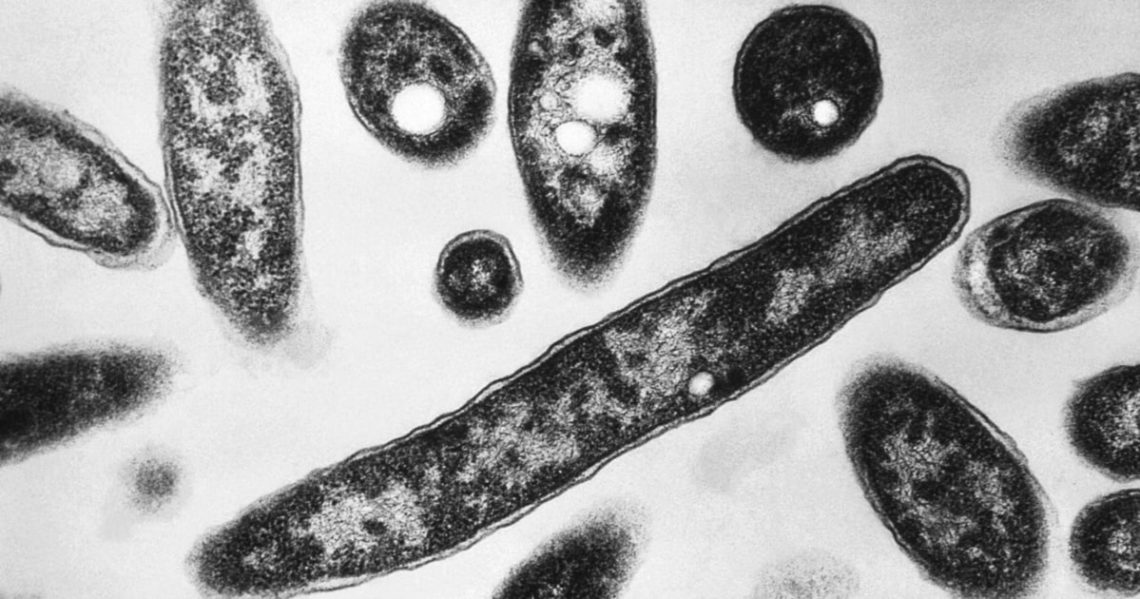1 dead, 22 sick from Legionnaires’ cluster in Harlem, health officials say