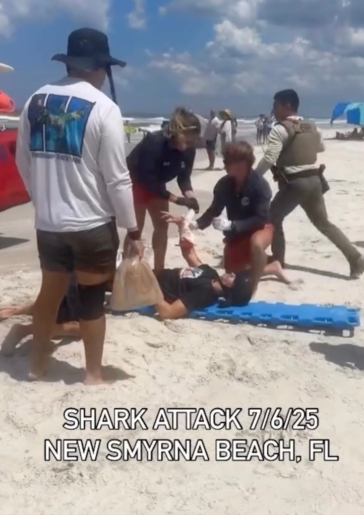 Shark attack victim receiving medical attention on New Smyrna Beach, Florida.
