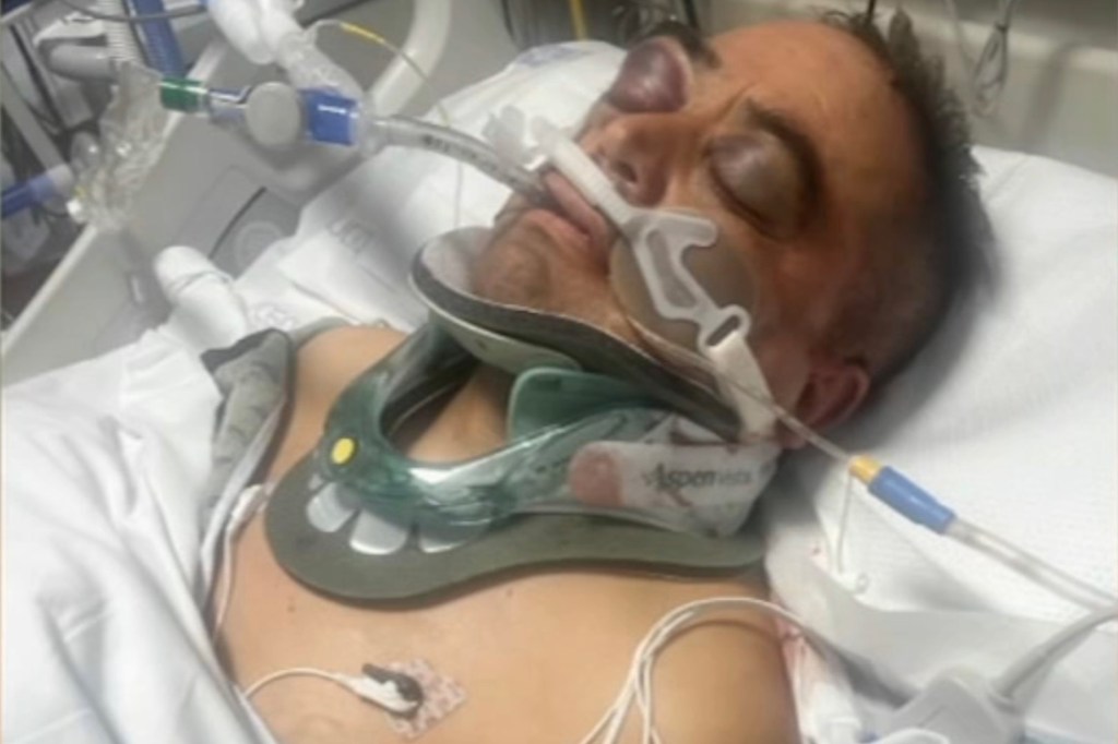 Injured farmworker in a hospital bed.