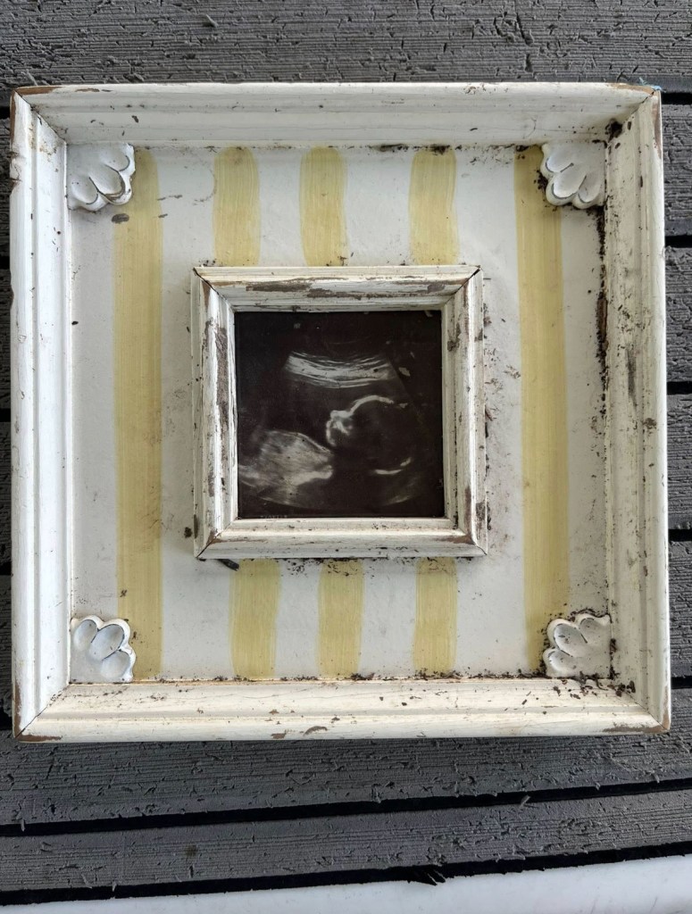 Lost ultrasound image in a distressed white frame with yellow stripes.