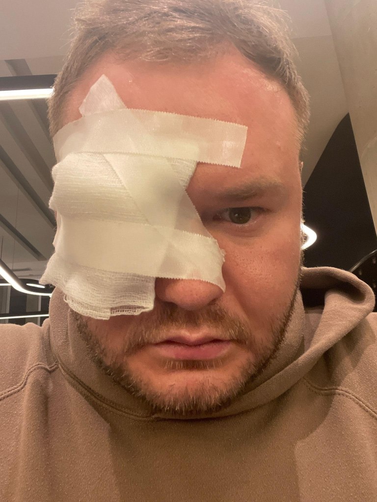 Lanchinskas, who owns a top ranked martial arts school in Brooklyn and is seen here with his right eye completely covered in white bandages, was on his way to a judo championship in Peru when he was hurt.