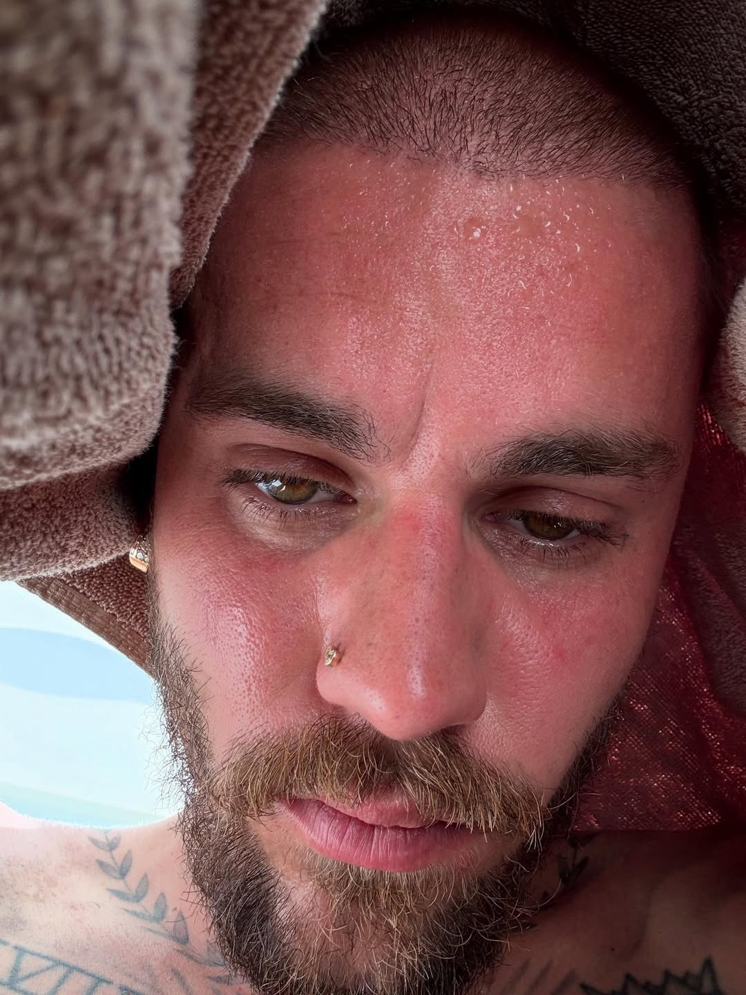 Justin Bieber sweating during detox