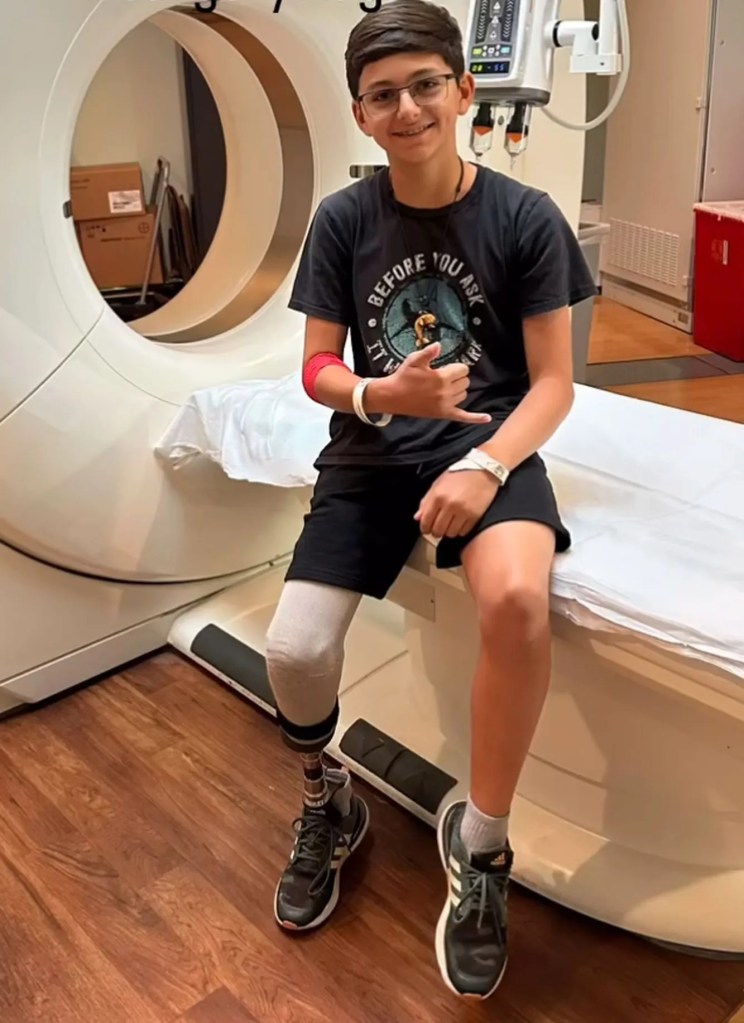 A boy with a prosthetic leg sits on a hospital examination table near a CT scanner.