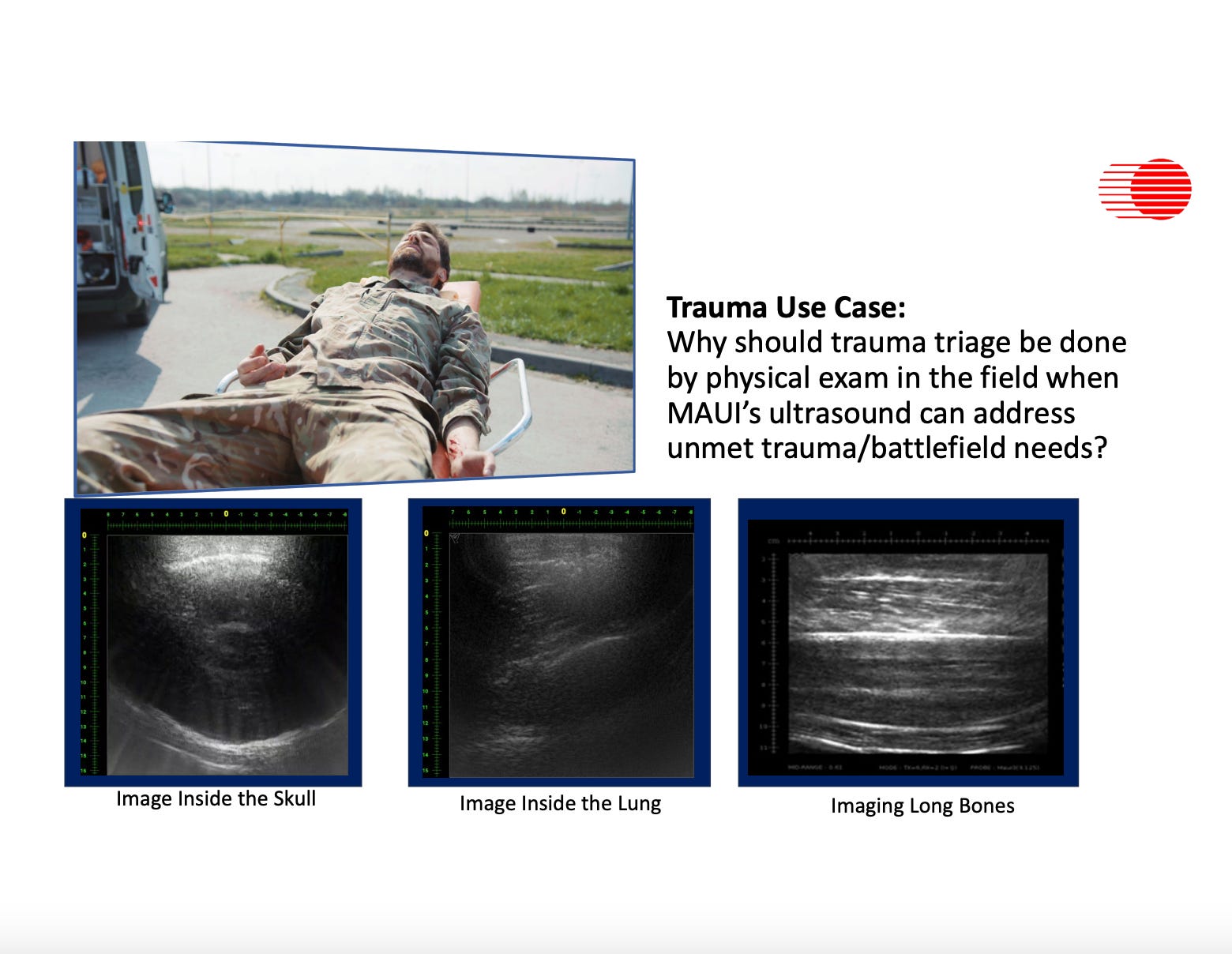 Trauma Use Case: Why should trauma triage be done by physical exam in the field when MAUI's ultrasound can address unmet trauma/battlefield needs?