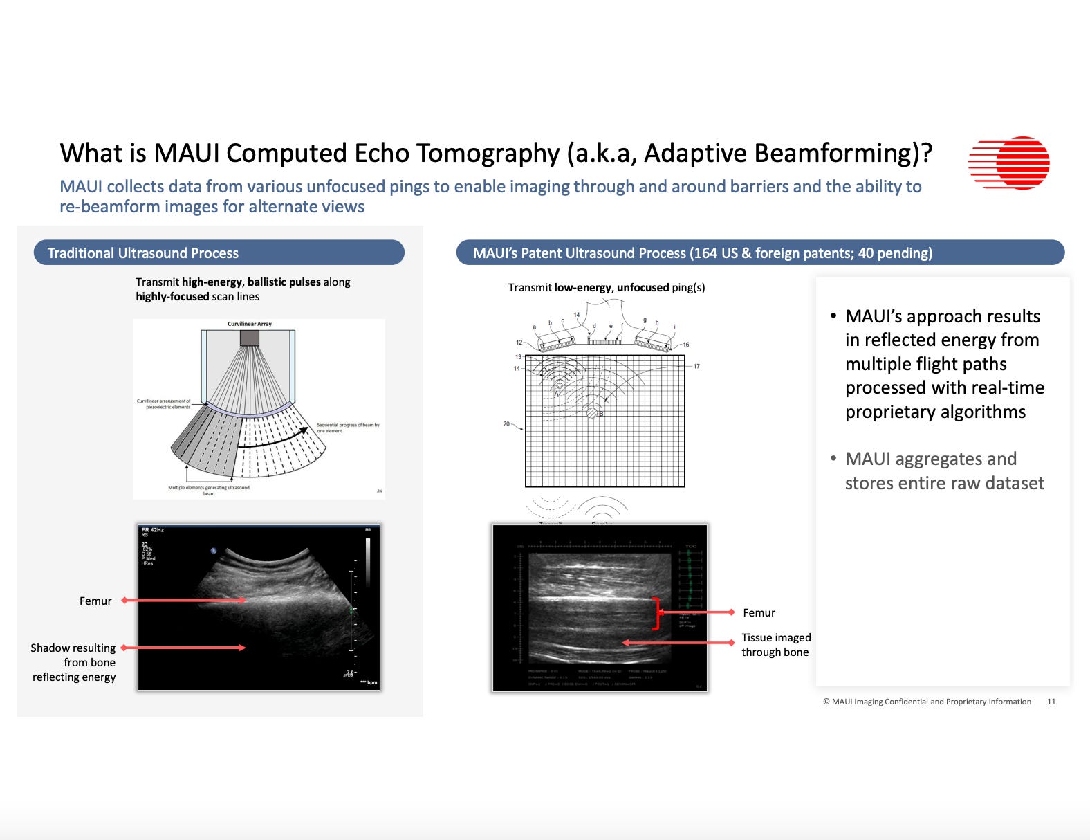 What is MAUI Computed Echo Tomography (a.k.a, Adaptive Beamforming)?