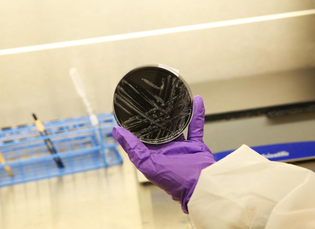 Legionella pneumophila bacteria culture on a petri dish.