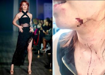 Aspiring Thai model viciously beaten at NYC subway station by ex-con out on bail as she pleads with him to stop: prosecutors