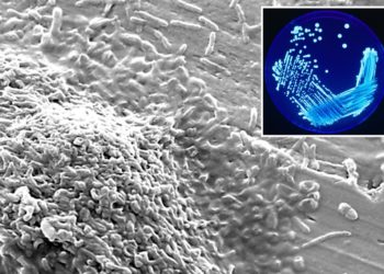 Cluster of Legionnaire’s disease cases found in NYC as health officials on alert