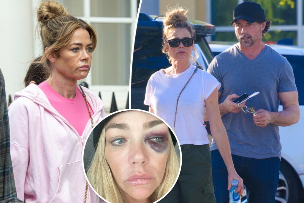Denise Richards reveals chilling details of violent Aaron Phypers fight that was last straw before divorce