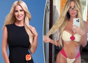Kim Zolciak breaks down every plastic surgery procedure she’s had done