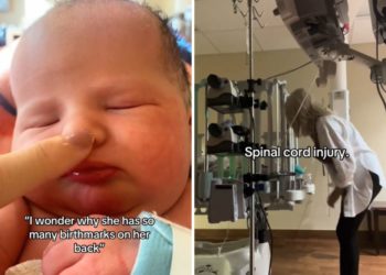 Mom Notices Baby Has Birthmarks on Back, Then Comes Heartbreaking Diagnosis
