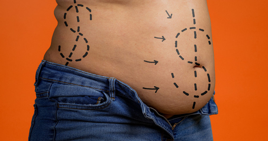 Patients allege that cosmetic surgeries led to disfiguring injuries