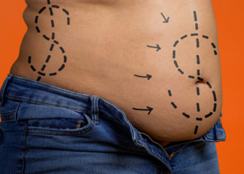 Patients allege that cosmetic surgeries led to disfiguring injuries
