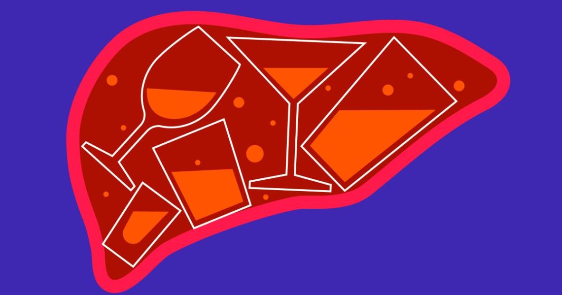 Serious liver disease is up among heavy drinkers, even without more drinking