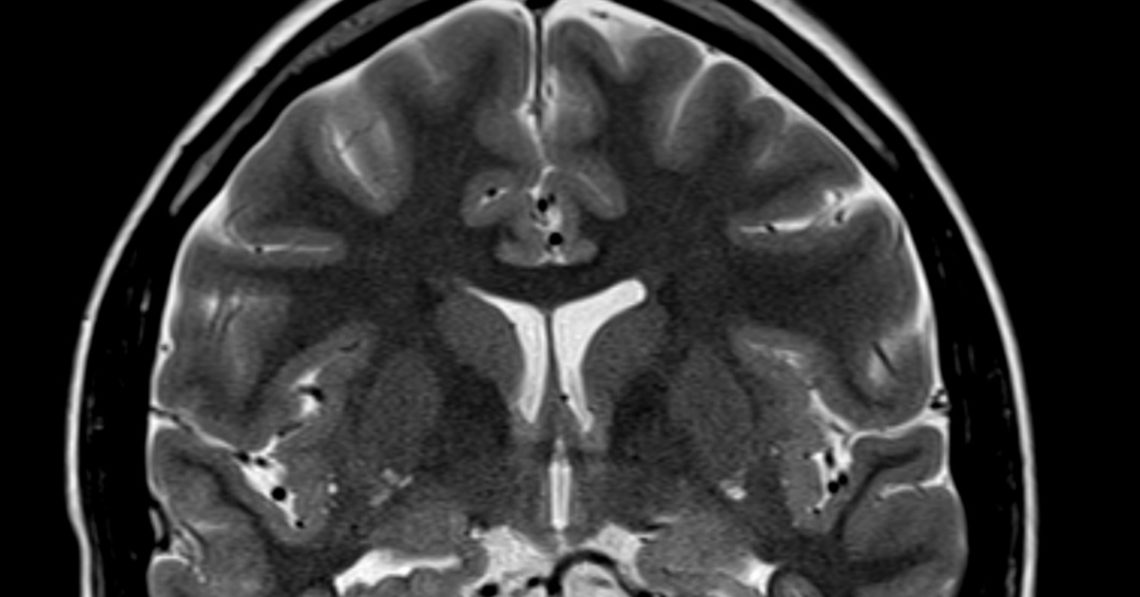 The Brain’s Best Defense Against Aging Could Be Your New Favorite Hobby