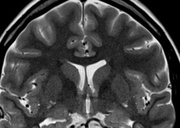 The Brain’s Best Defense Against Aging Could Be Your New Favorite Hobby