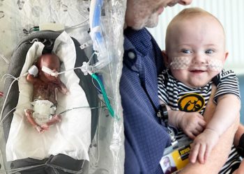 World’s most premature baby defies all medical odds to reach 1st birthday