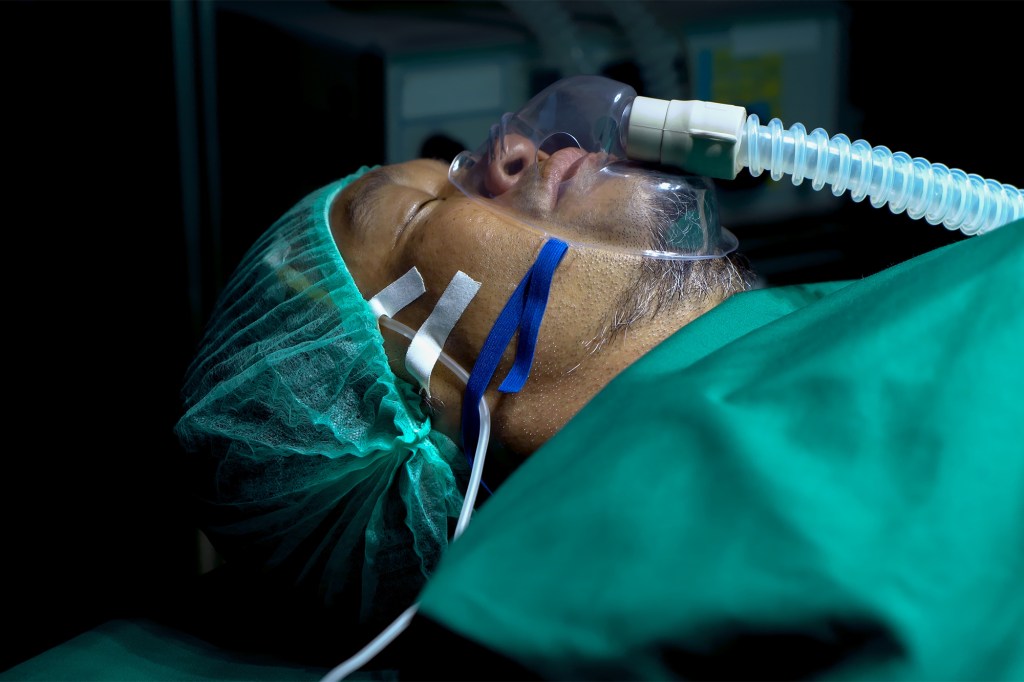 Close-up of an intubated male patient in an operating room.