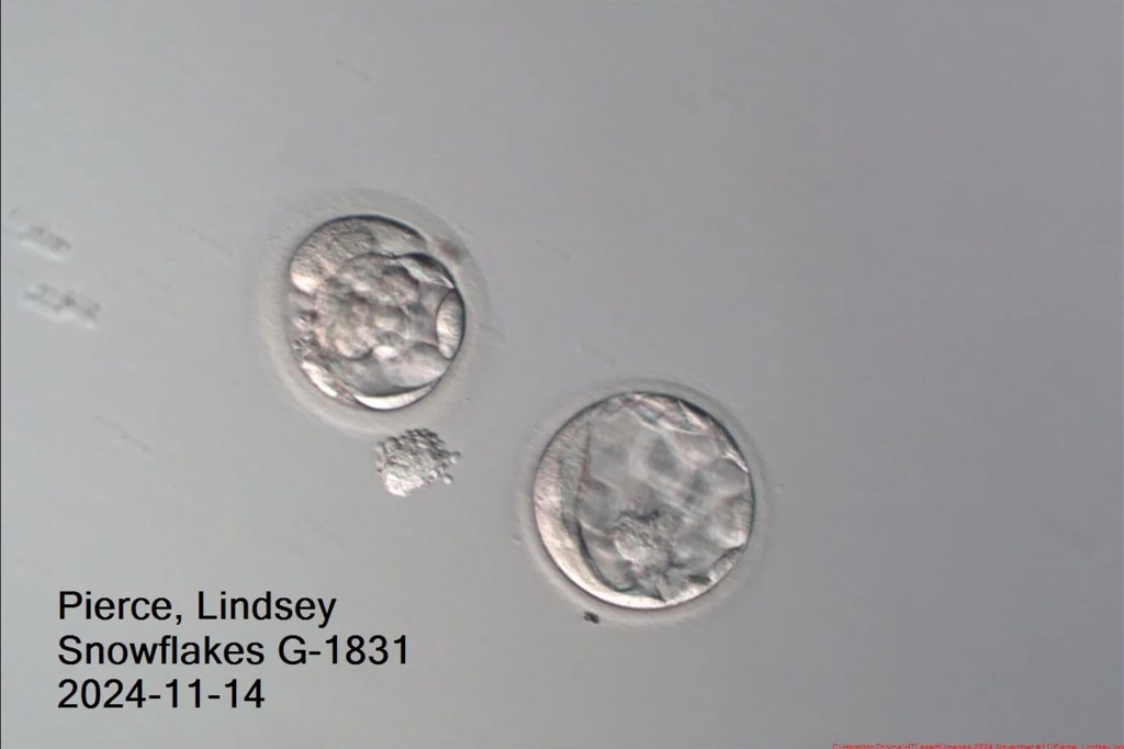 Microscopic image of two embryos.