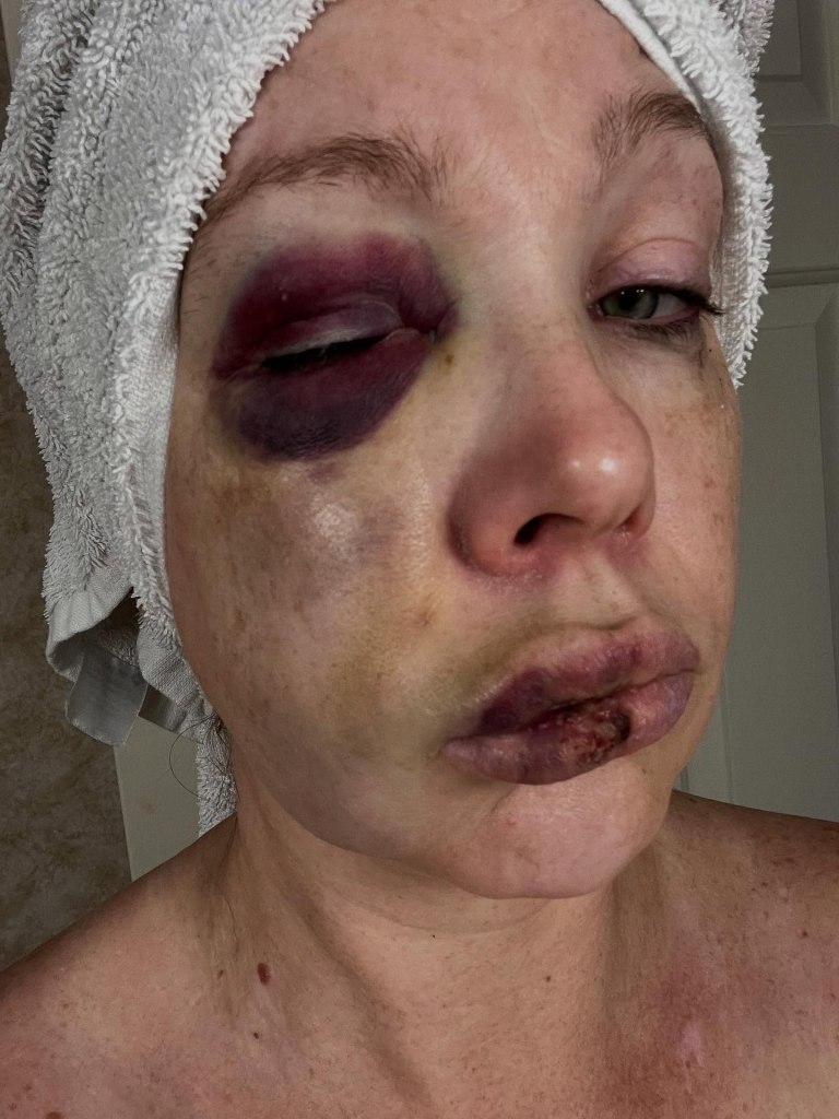 Cincinnati Jazz festiva beating victim 'Holly' images released by Sen. Bernie Moreno